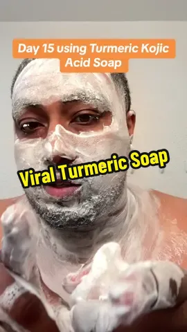 Day 15 using the viral @Inlifay Turmeric Kojic Acid Soap! Look at the progress I have made so far! Follow me on my 21 day journey 😃 #turmericsoap #turmerickojicacidsoap #kojicacidsoap #lemonturmerickojicacidsoap  #inlifay #skincare #viral #fyp #darkspotremoval #TikTokMadeMeBuyIt #TikTokShop #tiktokshopfinds 