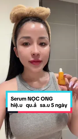 Serum mụn Nọc Ong , không hiệu quả 1 đề.n 10 nha mọi người . #Almond #mụn 