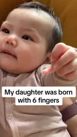 Maia is adorable ❤️ (@Kandace | Mom Life) #polydactyly #momlife #surgery 