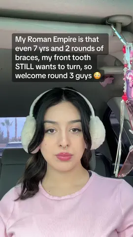 Lil storytime? 👀 #braces #teeth #sidewaystooth #toothupdate 