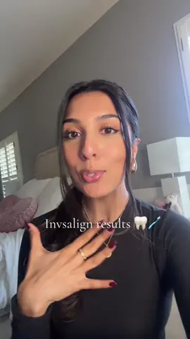 Shocked at how much Invisalign improved my smile! Thank you @Tend!! #invisalign #invisalignresults #greenscreen #greenscreenvideo 