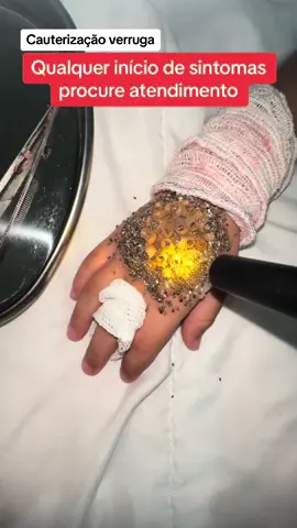 #asmr #pimple #blackhead #tripophobia #conscientização #trypophobia make artistica para conscientizar a procura por atendimento no início dos sintomas 