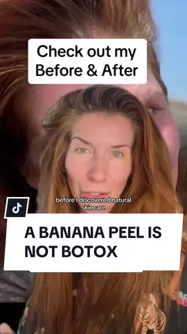 #stitch with @Kate 👩🏻‍🦰 Im happy your skin is healthy. Skincare isnt toxic and it can be affordable ❤️ Does a banana peel work for skin and why? Rose water is an ancient method. Its actually considered a skincare ingredient. Castor oil is dense and good for dry skin. #naturalskincareroutine #castoroil #dermtotiktok #bananapeelskincare 