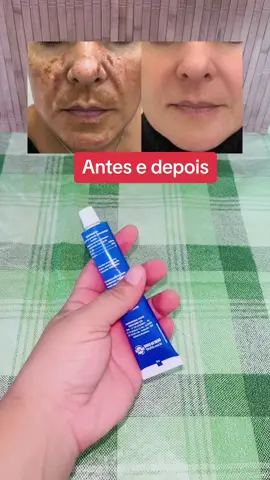 Pomadimha do milagre