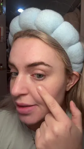 Replying to @T yessss. I look back at my before pictures and im just so impressed on all the plumpness that has gone back into my skin #koreanskincare #undereyecream #TikTokMadeMeBuylt #skincaremusthaves #undereyebags #undereyecircles #koreanskincareproducts #skincareroutine #musthaves #fyp #beforeandafter 