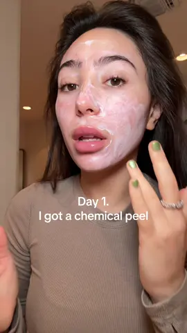 my skin better be a 10/10 after this! also, if you watched this video or see me out… no you didnt! lol. 