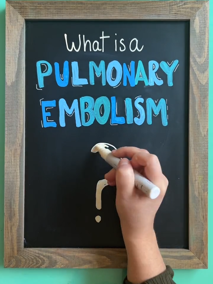 🫁 Pulmonary Embolism 🚨Let me know what other topics you’d like to see in the comments! 💕 #nursingschool  #nursingstudent  #pulmonaryembolism  #pulmonary  #medsurg  #visuallearning  #futurenursesoftiktok  #futurenurse  #nursingtiktok