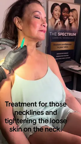 Concerned about the loose sagging skin on your neck? Hyperdilute radiesse has shown to tighten that skin and reduce the appearance of wrinkles by promoting collagen production. #radiessehyperdilute, #byeneckwrinkles, #GlowUp, #fyp, #GlowUp
