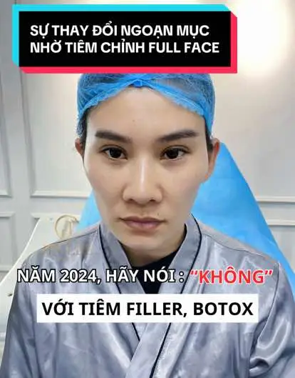 #jinleebeauty #viral #xuhuong #xuhuonglamdep #fillerhanoi #filler 