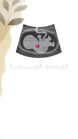 بشارة حمل للعمات ب10 ريال فقط للطلب تواصل واتس 0551183034 #بشارة_حمل_للاهل #بشارة_حمل_للجده #بشارة_حمل_للخالات #بشارة_حمل_للزوج #بشارة_حمل_للعمات #اكسبلور #اكسبلورexplore #explore #fyp #بشارة_مولود #بشارة_مولودة #بشاره_حمل #حمل #حامل