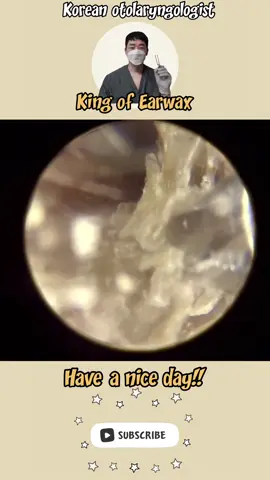 @귀지형 #귀지#귀지제거 #귀파기 #귀파기asmr  #귀청소 #이비인후과 #earwax #earwaxremoval  #asmr 
