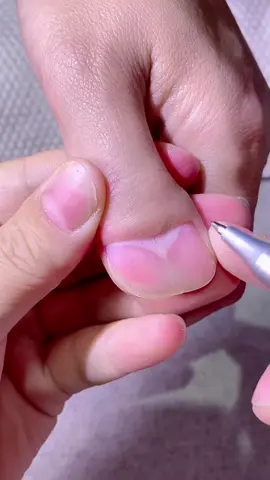 No matter the shaped of the nail, it’s the same procedure 