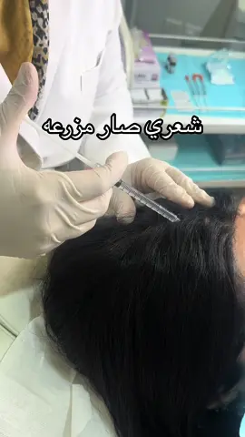#اكسبلور #fyp 