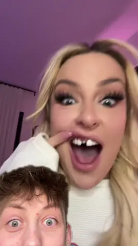Tana mongeau’s teeth fell out 😳 #tanamongeau #cancelledpodcast #veneers #teeth #tooth #dentist #news #fyp #greenscreen #greenscreenvideo 