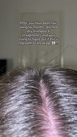 Is it new hair growth or breakage❓no splits ends there & hair feels smooth so I’m hoping for regrowth 🌱#hairregrowth #hairgrowth #hairbrakage #hairgrowthjourney #hairbreakagetips #hairregrowthtips #hair #CapCut 