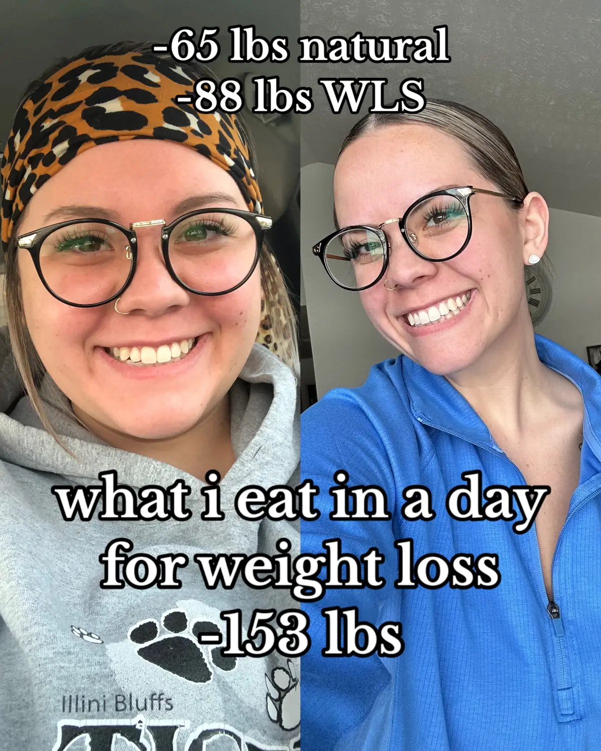 #weightloss #weightlossjourney #weightlossprogress #weightlosstransformation #weightlosscheck #weightlossmotivation #weightlossjourney #weightlosschallenge #weightlossbeforeandafter #weightlossgoals #weightlossfood #ditl #wieiad #wieiadrealistic #wieiadweightloss #wieiadhealthy #Fitness #fitnessmotivation #fitnessroutine #fitspo #fitnessjourney #rny #rnycommunity #plussizegymgirl #plussizeweightloss #gymgirl #premierprotein #proteincoffee #proteinshake #proffee #proffeetok #highproteinmeals #sugarfree #sugarfreecoffee #nurse #nursesoftiktok #nurselife #nurseproblems #pediatricnurse #pedsnurse #nursemealprep #nurseditl #bariatricsurgery #bariatric #bariatricmeals #bariatricmealprep #celebratevitamins #bariatricvitamins #mealprep #easymealprep #weightlossmealprep #mealprephacks #wls #wlsfoods #wlshacks #wlsjourney #weightlosssurgery #macrocounting #macrogoals #fyp #foryou #foryoupage 