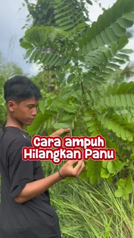Pake ini sebelum pacar tau kamu panuan 🤮
