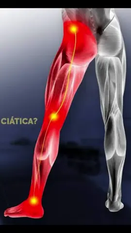 Teste pra saber se a sua dor na perna é nervo ciático! #ciatica #ciatico #dorciatica #dornacoluna #dornalombar #dornascostas #herniadedisco #coluna 