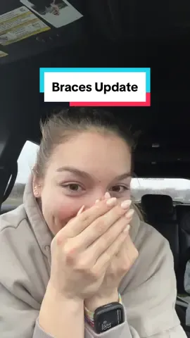 Okay so I MIGHT be attached #bracestok #braces #bracesoff #bracesguide #bracescheck #bracestips #bracescolors #orthodontist 