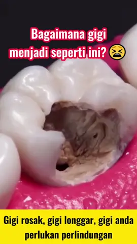 Bagaimana gigi menjadi seperti ini?Gigi rosak, gigi longgar, gigi anda perlukan perlindungan#Buang ubat gigi yang tidak berguna