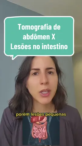 Os coloproctologistas são os especialistas que podem diagnosticar o motivo desse desconforto! Ahh… se ficou alguma dúvida? Pode me chamar no Direct que eu respondo para você! 😉
‌ Dra. Lorena Willers Médica Coloproctologista CRM 172.373 | RQE 66.686 #dralorenawillers #proctologia #aproctologista #proctologiaparavocê #hemorroidas #saudedointestino #coloproctologista #proctologistasaopaulo #fissura #diverticulite #diverticulos #sindromeintestinoirritavel #constipada #constipação #sii #constipado 