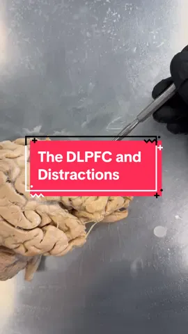 The dorsolateral prefrontal cortex and its role in managing distractions. #Brain #Neuroscience #Anatomy #ScienceClass