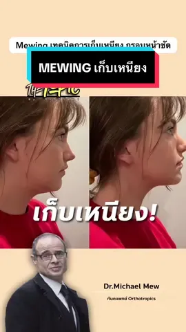 วิธีเก็บเหนียง #เก็บเหนียง #Mewing #เรื่องนี้ต้องเล่า #thetopic 