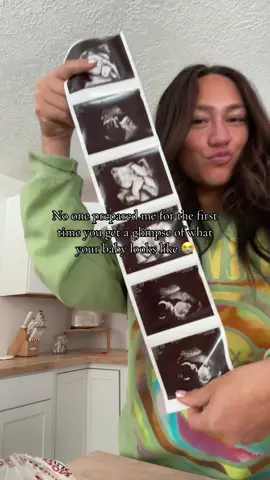 My favorite appointment to date omg🥹😭 #ultrasound #pregnantmama #firsttimemom #momtobe 