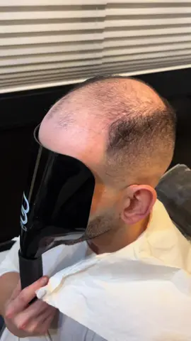 Hairagain e’ il cambiamento     #haireplacementsystem  #trapiantocapelli  #exstension #parrucchiere  #toupe  #toppik  #patchcutanea  #parrucca  #hairstyle  #parrucca  #alopecia  #alopeciareata  #infoltimentocapelli  #protesicapelli  #lacewig  #haircut  #hairexstension #toupeformen  #protesicapelliuomo #capelli  #parrucchiere  #cambiolook  #trasformazione  #hair #tagliocapelli  #colorecapelli  #wig