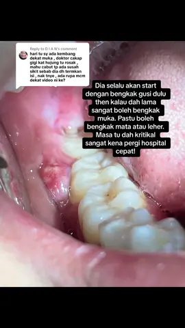 Replying to @D I A N #Hello2024 #dentistpasirgudang #doktorgigipasirgudang #dentalclinicpasirgudang #klinikgigipasirgudang #fypシ゚viral #shouldbeme #fyp #fypage #pasirgudang #jbstyle #jbstyle🔥 #fyp #fypage #pasirgudang #drqdentistpasirgudang 