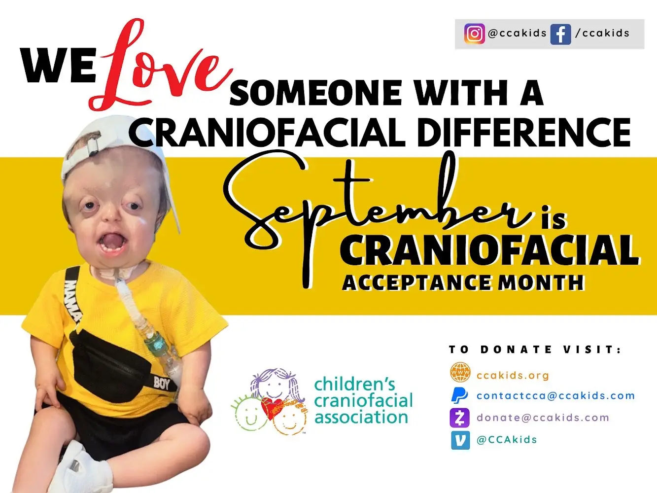 Totally forgot to post this in September 💜 SOOOO blessed with family and friends that continue to show up for us! #risewithraedyn #pfeiffersyndrome #craniosynostosis #facialdifferences #trachbaby #tubielife #acceptance #inclusion 