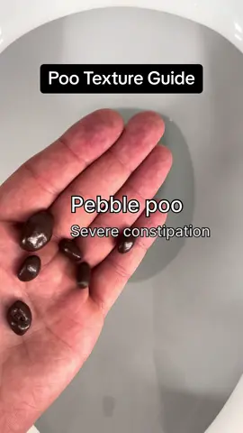Hi, what texture was your poo today? 🤔 Tell me 👇