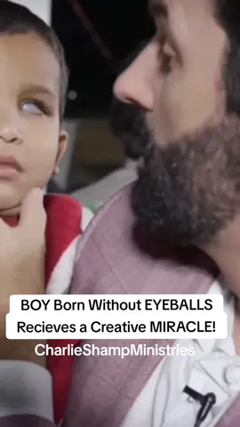He Was Born Without Eyeballs! #charlieshamp #creativemiracle #blindcansee #miracles #healed #healingmiracle #praisethelord #healing #healedbykingjesus #jesuslovesyou #jesuschrist #fy #deliverance #healingministry #faithhealing #godisgreat #fyp #fypシ゚viral #amazing #godisreal #testimony #healingcrusade #castoutdemons #jesuschristo #spiritualwarfare #faith #Love #hope #miracleshappen #foryou #miraclesfromheaven #holyspirit #God #glorytogod #faith #jesus #presenceofgod #christianity #christianitytiktok #jesustok #christianitytok #scriptureclips 