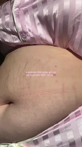 having fat on your body is completly normal❤️