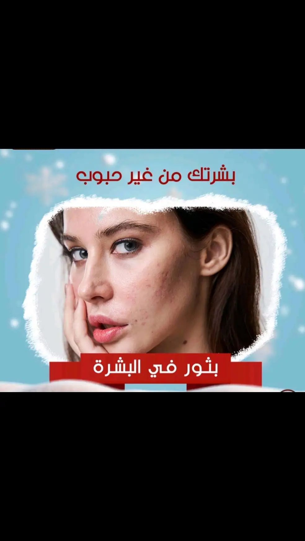 @pink_moon20  —— منتجات طبيعيه بالصبار   بشرتك من غير حبوب 🥰☺ اتخلصي من الحبوب تحت الجلد ، الحبوب الحية ، بثور البشرة . * مع  الصبار  الطبيعي  ودعيهااا  وانسي  وجودهااا #حبوب_الوجه #منتجات #طبيعي #اكسبلور_2020 علاجات#علاجات_طبيعيه  #مصرحه_من_هئية_الدواء_والغذاء  #2024bride   