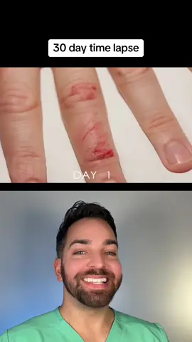 🤯 #dermatologist 