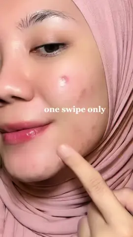 yg punya kulit acne prone skin merapattt!! wajib bgt cobain foundation ini jadi aman bgt ga takut jerawataaan🥹👍🏻 #makeup #foundationforacneproneskin #makeuptips 