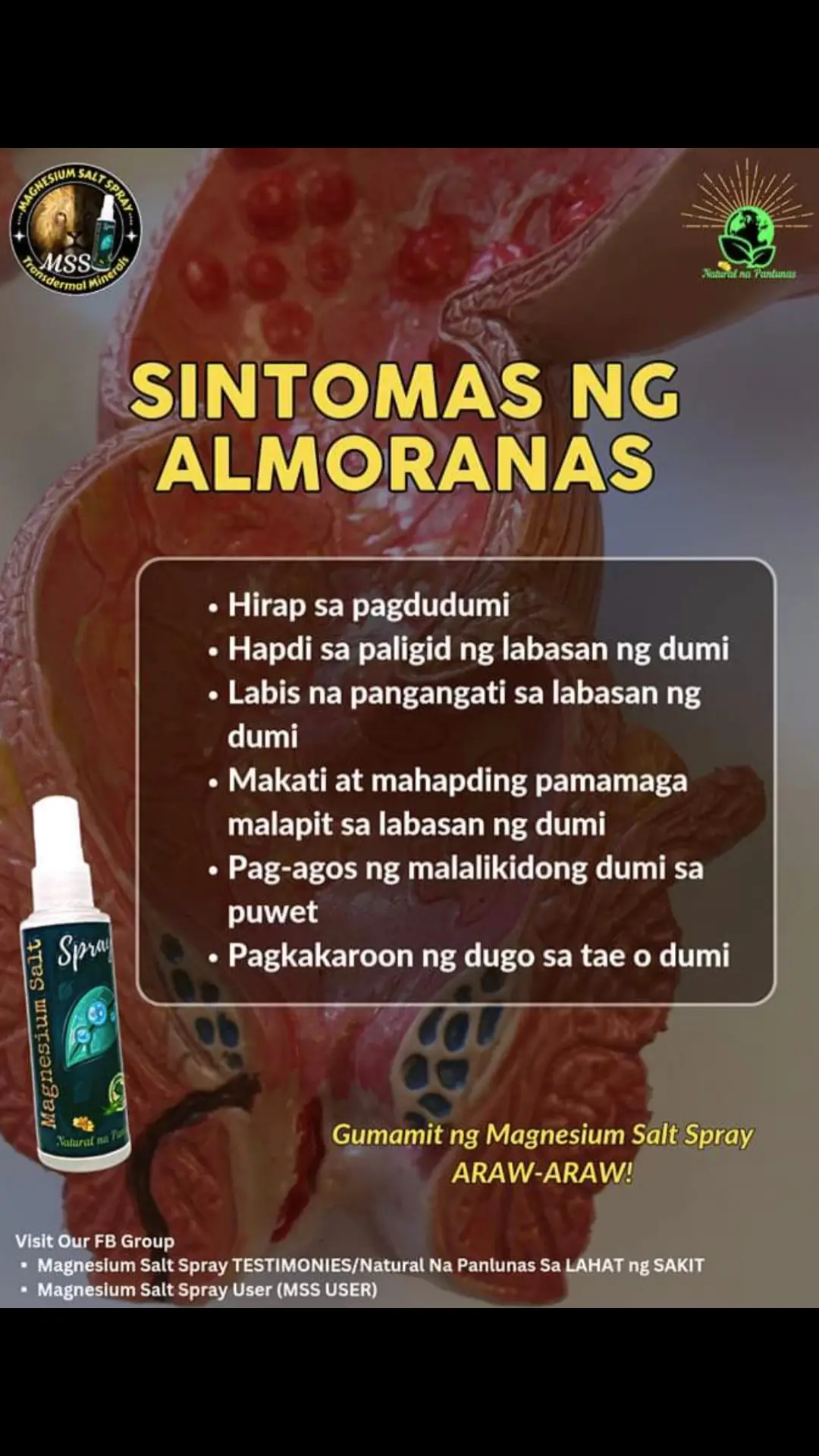 #HEMORRHOIDS  Paano gamitin ang MSS  Sprayhan ang mga sumusunod: -Kahabaan ng Spinal mula batok hanggang puwetan -kilikili -talampakan -pusod -at apektadong parte na may problema #NATURALnaPANLUNAS #MAGNESIUMsaltSPRAY #sprayatpahidlanggagalingkana  #transdermalmineralsupplement #allinone #MSS #miraclespray #health 