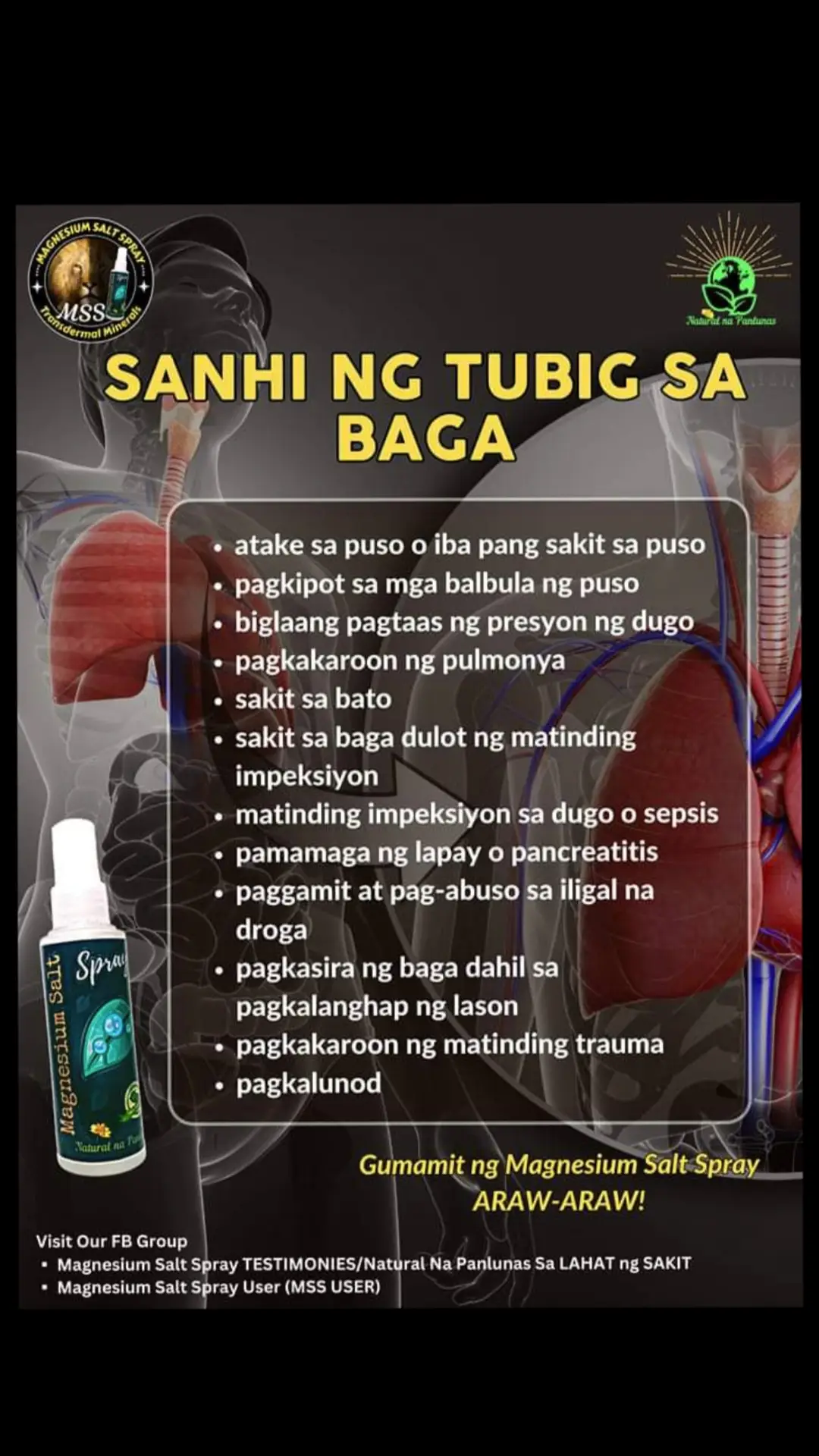 Dapat na malaman ang mga senyales at SINTOMAS na may TUBIG na sa BAGA,para maagapan ang anumang komplikasyon. -hirap sa paghinga(dyspnea)na lumalala kapag gumagalaw,at kahit pa nakatigil o nakahiga lang -pakiramdam ay nalulunod o naninikip  ang dibdib, at parang naghahabol ng hininga -minsan ay may pag-aagahas(o wheezing sound) -nanlalamig at nagpapawis ang mga palad,at maaring magpawis din ang buong katawan -nanghihina,hindi mapakali,balisa -umuubo,mula bahagya hanggang may kasama nang kaunting dugo -nangingitim na mga labi -mabilis at hindi regular ang tibok ng puso(palpitations) -walang ganang kumain low blood oxygen level (hypoxia) Para makaiwas sa ganitong uri ng sakit.. Gumamit ng Magnesium Salt Spray ARAW-ARAW! #NATURALnaPANLUNAS #MAGNESIUMsaltSPRAY #sprayatpahidlanggagalingkana  #transdermalmineralsupplement #allinone #MSS #miraclespray #health 