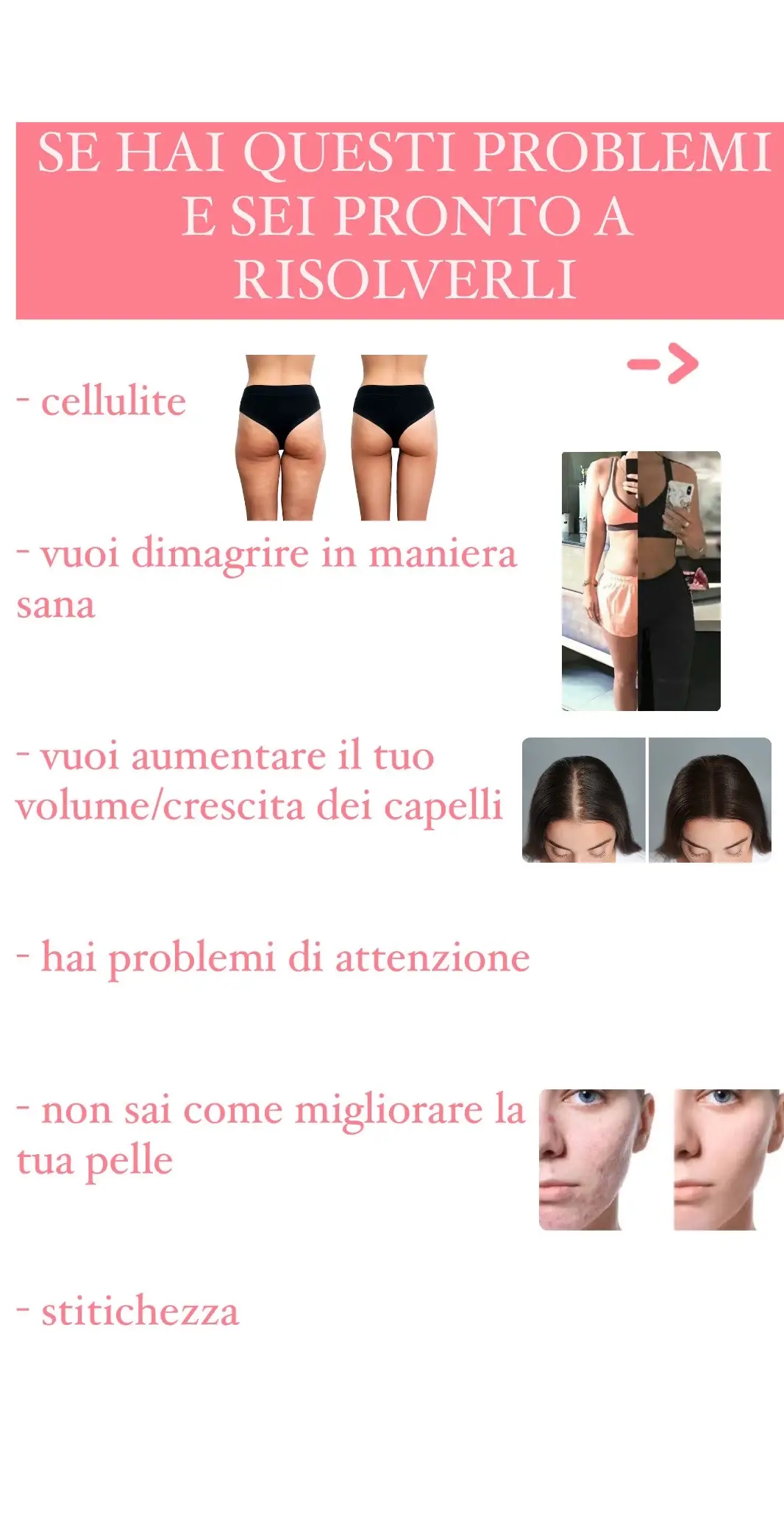 #consigliutili #consigliragazze #consigliragazze🦋 #consigliperte #consiglicapelli #crescitacapelliveloce #crescitacapellipiùrapida #problemidiattenzione #cellulite #cellulitetips #celluliteremoval #perditapeso #perditadipeso #perditadicapelli #perditapesoveloce #dietasana 