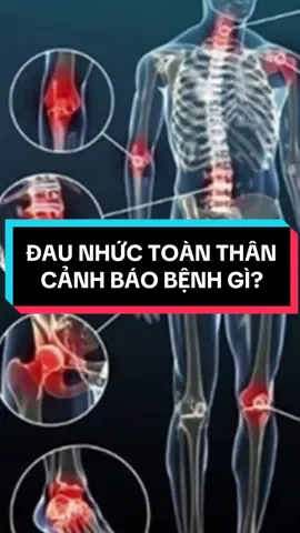 Đau nhức toàn thân cảnh báo bệnh gì? #xươngkhớp #đauvaigáy #đaunhucxuongkhop #đaulưng 