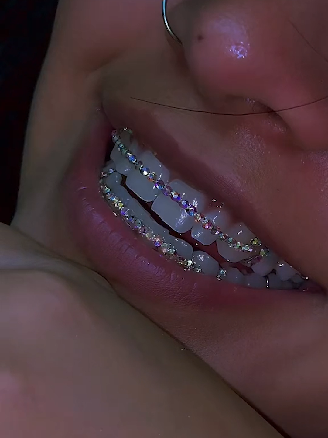 Is This Retainer Really Is Worth $1,000,000?! 💎💸 #retainer #ice #teeth