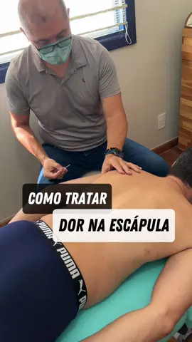 Tratando de dor periescapular com #acupuntura #dryneedling #agulhamentoaseco #terapiamanual #massoterapia #massagem 