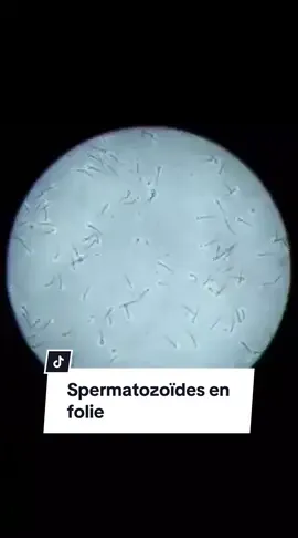 Vous vous demandiez ce qu’il se passait entre le recueil et l’injection dans l’ovocyte , voici ce que vous ne devriez pas voir 😂🕺🕺🪩 #fiv #pma #fivette #essaibebe #fivicsi #fivdo #procreationmedicalementassistee #dondegametes #pmette #infertilité #parcourspma #dondovocytes #fecondationinvitro #desirbebe #sopk #endogirl #essayeuse #ponction #iac #ovocyte #tec #insemination #inseminationartificielle