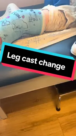 Leg cast change 🫶🏽 #legcast  #capcut #fyp #tibia #fibula 