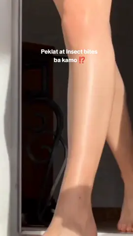 Tagal ko pang tiniis scars and insect bite marks ko eto lang pala solusyon ✨🥺 #fyp #foryoupage #verdefy #verdefyph #scar #stretchmarks  #scarremover #skinproblems lems #verdefyscarremovercream 