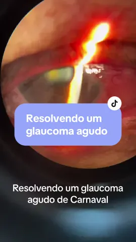 Glaucoma agudo para animar o carnaval 😰 #oftalmotiktok #olhovermelho #glaucoma #emergenciaoftalmologica #glaucomaagudo #dorocular #VozDaIvete 