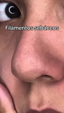 Filamentos sebáceos 🫠 #skincare #cravos #limpezadepele #vitacid #vitaminab12 #sop 