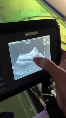 Take a look at our stingray Charlotte's ultrasound! Charlotte is a California round stingray who is currently expecting! Thing is, we have no male ray in the tank! One possibility is that the babies have gone through the process called parthenogenesis where the cell inside of the egg splits on its own and creates an exact clone of the mother. Another possibility is that she was impregnated by one of our 2 male white spotted bamboo sharks that we introduced to the tank in July 2023. We won't know for sure until DNA testing is done on Charlotte's pups. Stay tuned for updates on the pregnancy! #stingray #pregnant #aquarium 