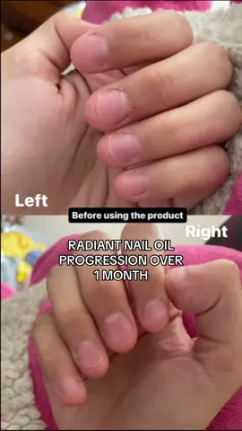 real time progress results!! #fyp #foryou #BeautyTok #beautytips #beautyhacks #nailgrowth #nailhealth #nailgrowthjourney #SelfCare #selfcareroutine #ad 